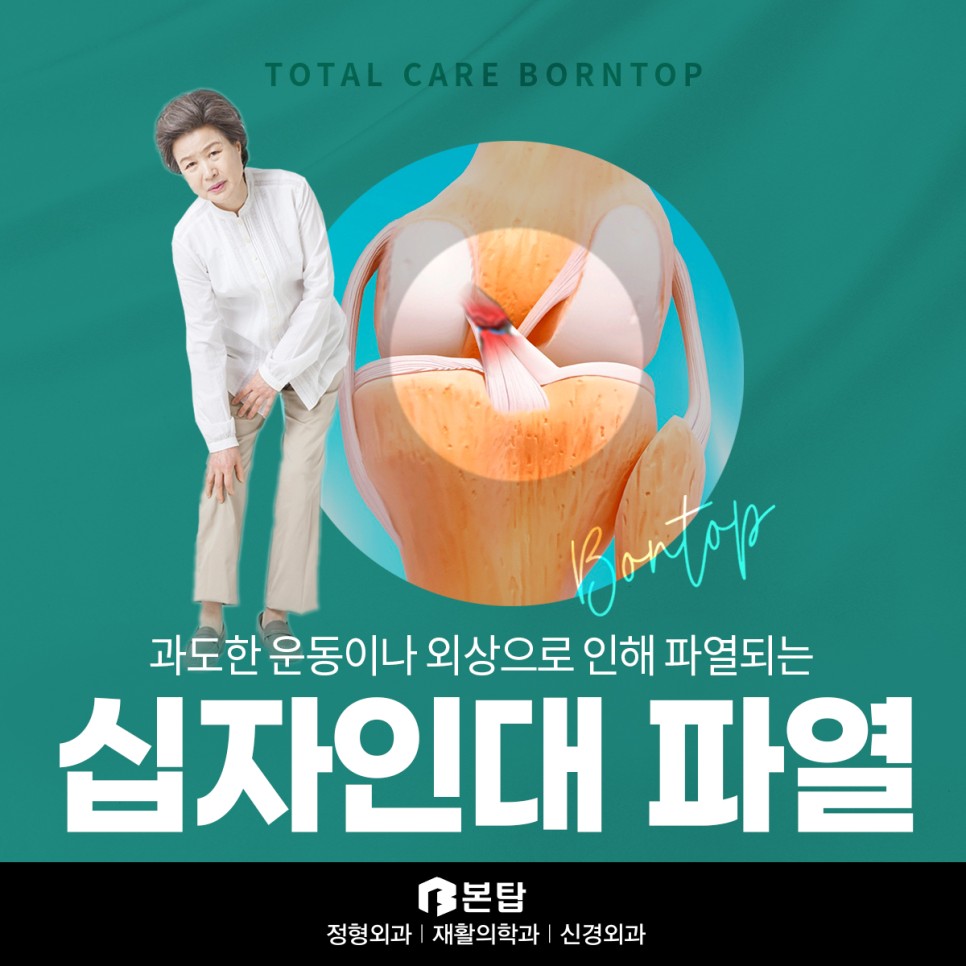 십다인대파열