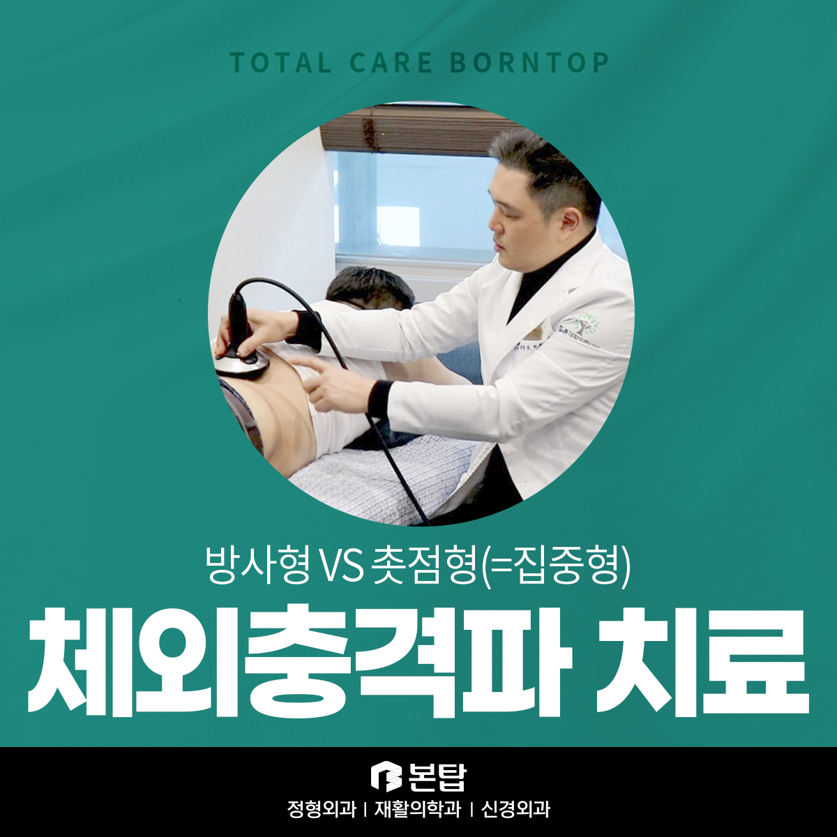 체외충격파